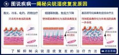 尖锐湿疣治疗的权威医院